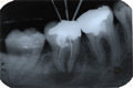 Endodontie